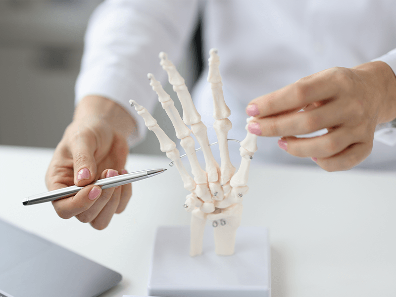 Surgery on a Broken or Fractured Finger: When Is a Broken Finger Surgery Needed?