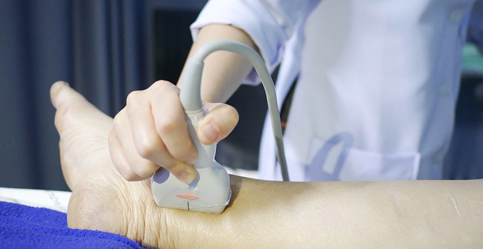 Is My Ankle Broken Or Sprained? A Guide To Telling The Difference Between These Common Ankle Injuries